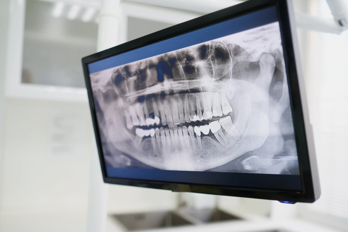 Can an ER actually treat a toothache