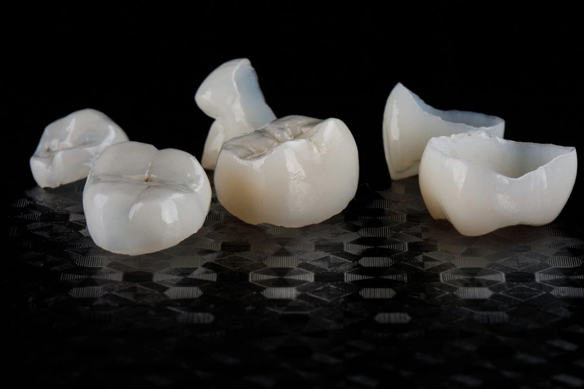 Dental Crown Vs Filling