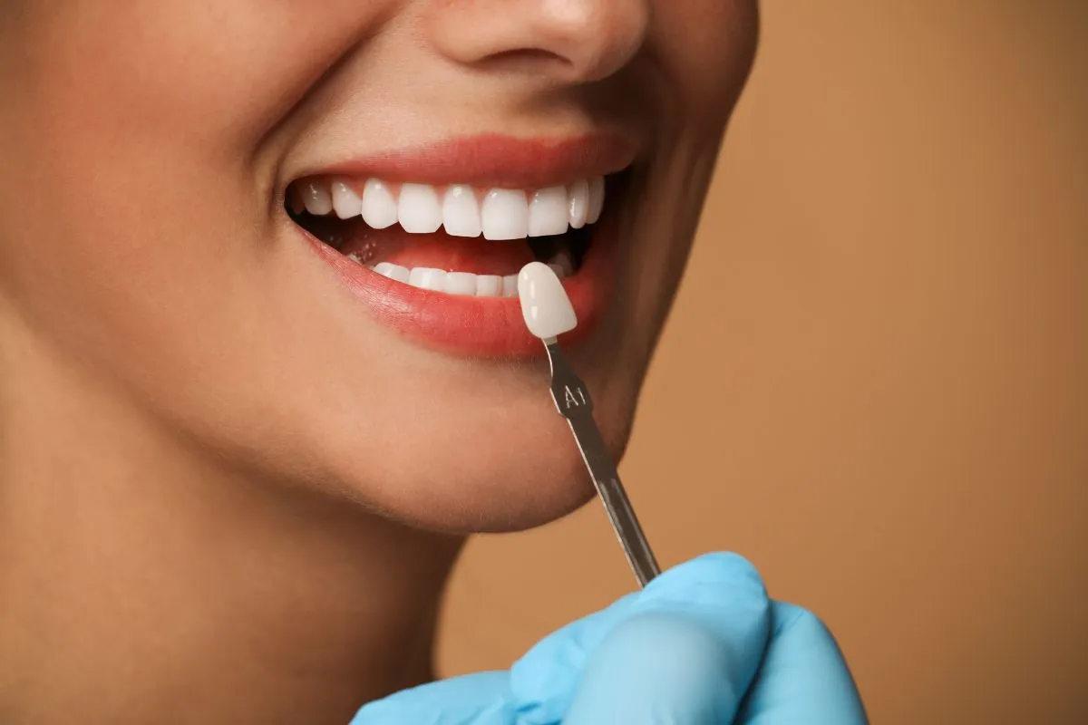 Dental Veneers in North York