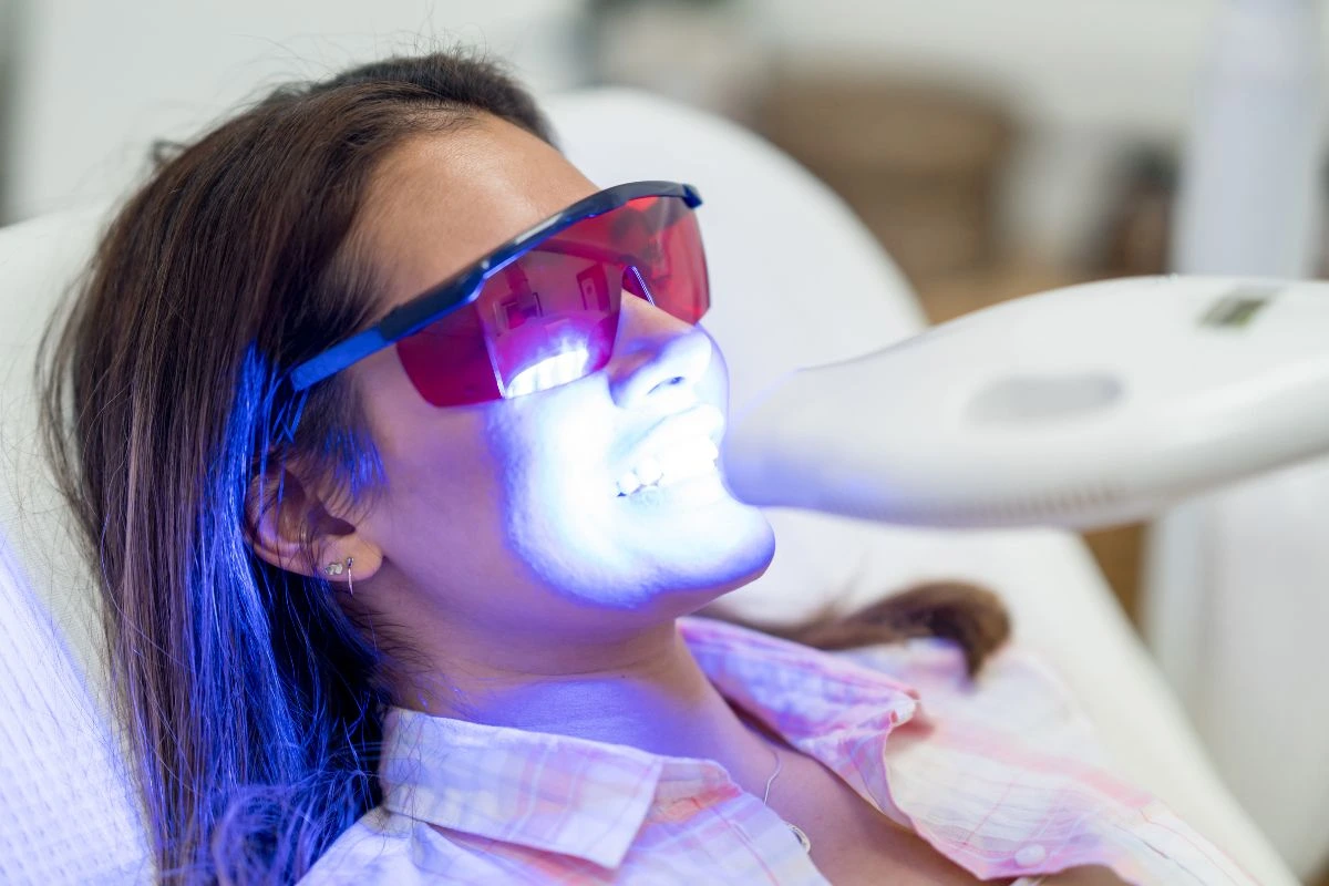 Dentist-Supervised Take-Home Whitening
