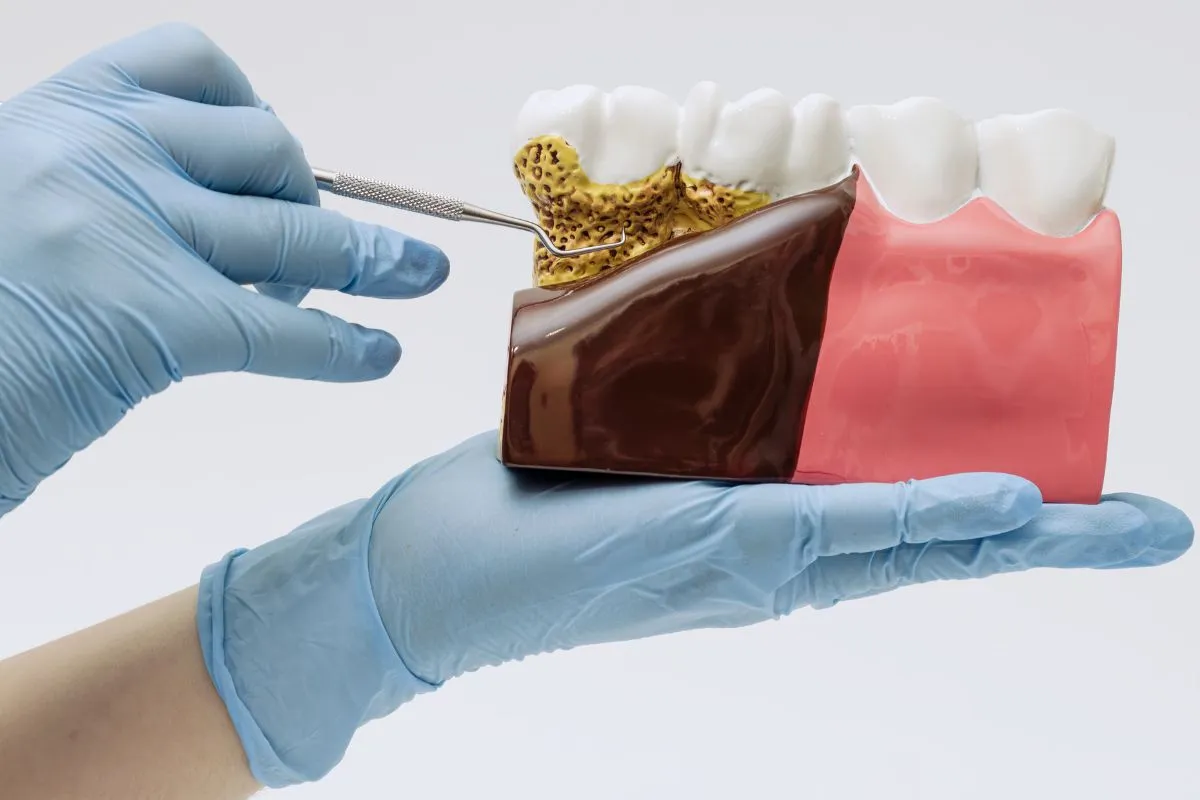 How Gum Disease Is Diagnosed