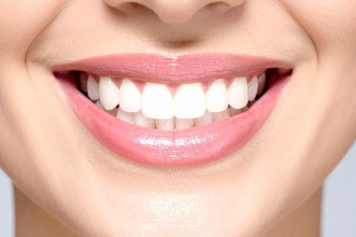 How Invisalign Works