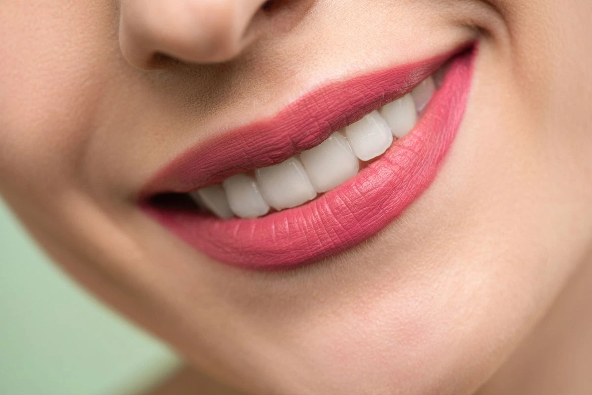 Professional Versus Store-Bought Whitening