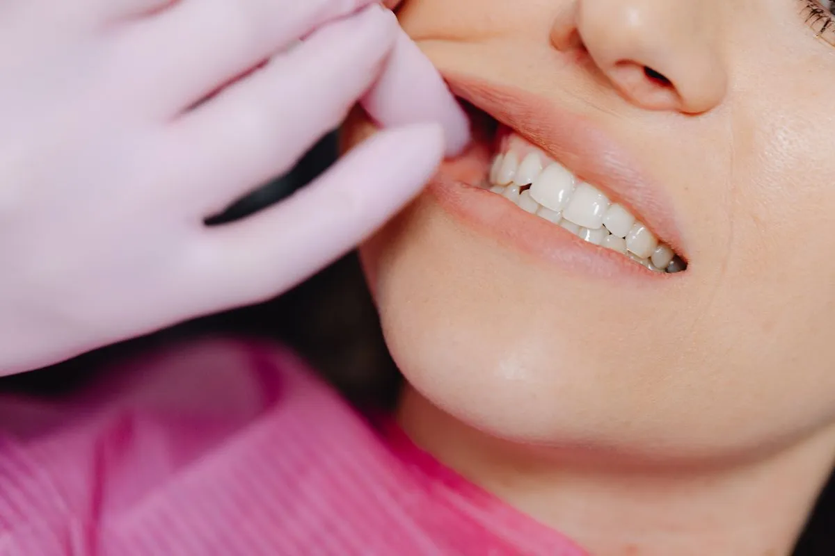 Signs of Gum Disease
