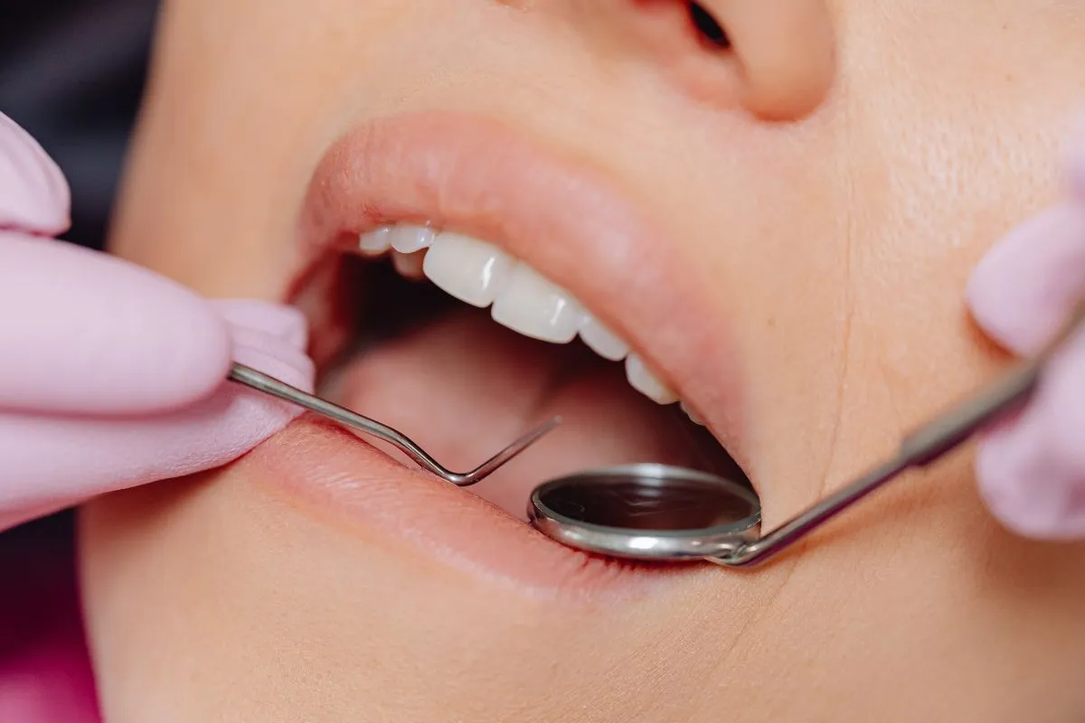 Types of Veneers We Offer