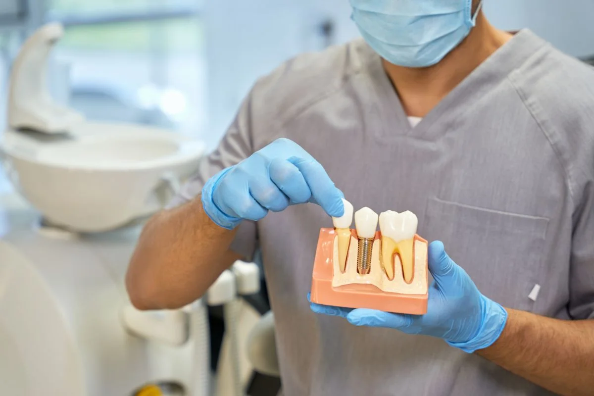 What Is a Dental Implant