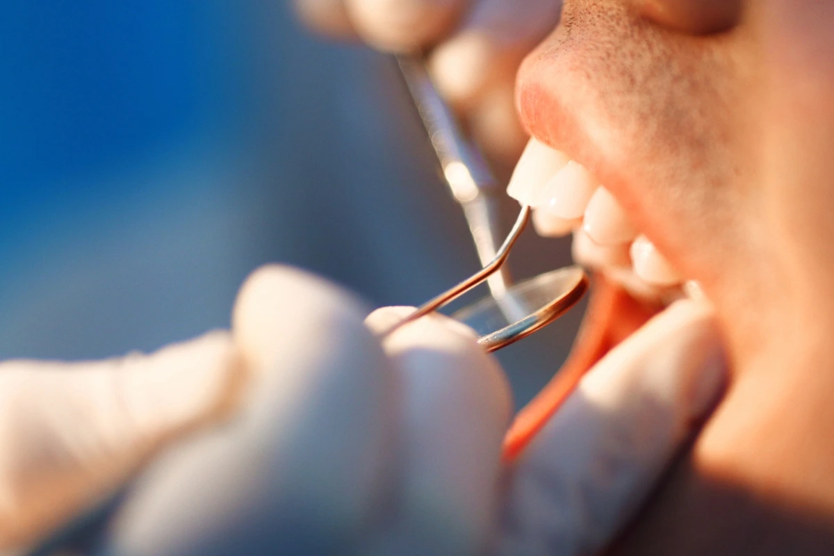 What counts as a knocked-out tooth emergency