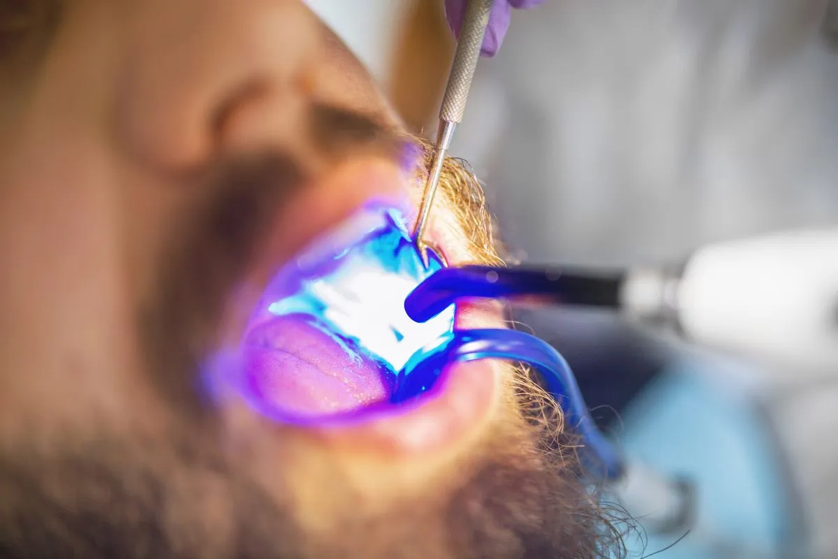 When Might a Tooth Need a Filling